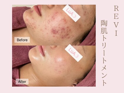 ルア(LuA.)の写真