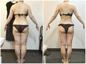 美容整体 ウェリナ 蟹江院/小顔矯正/骨盤矯正/美脚サロン