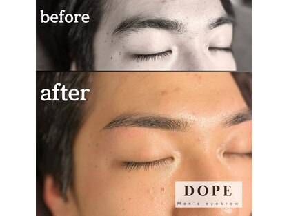 【DOPE:ドープ】新宿駅前（メンズ眉毛サロン/眉毛専門/アイブロウ/眉毛パーマ/まゆげ)の写真