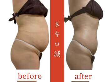 ウィズルーチェ 神栖店(with luce)/痩身効果★ダイエットに終止符を