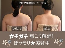 ミトラ(MITRA)/アロマ整体ドレナージュ8回施術