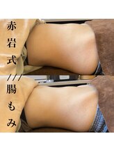 バーム(BAUM.)/結果の出る腸もみ★赤岩式