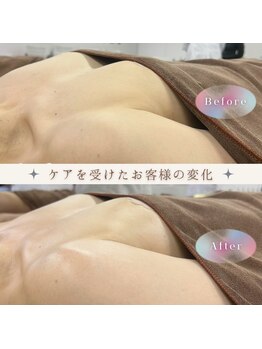リアン 栄店(Lien)/産後ママ１度の施術で効果実感◎
