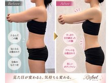 ラフィールの雰囲気（初回で即実感 !! サイズダウン《ビフォーアフター》に自信あり。）
