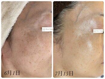 ブラン ネージュ(Blanc Neige)/タラソトリートメント