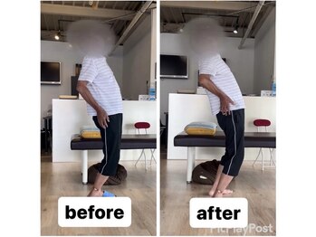 カワル整体 上通り院/【歩くとフラフラする】