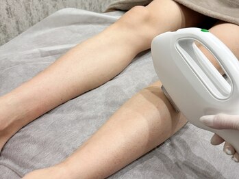 スキル アイラッシュ(SKILL eyelash)/メンズ脱毛☆両脚/足指