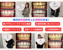 ホワイトニングショップ 津田沼店
