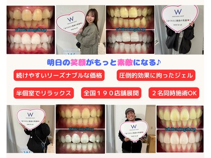ホワイトニングショップ 津田沼店の写真