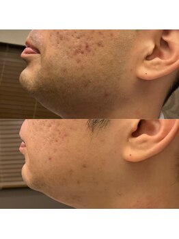 フェリーバ 流山店(FELIVA)/お肌も綺麗になります!