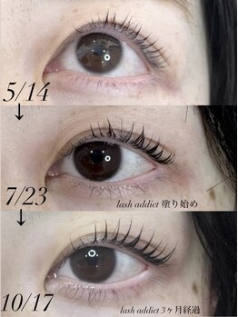 ミニョン(Mignon)/lash addict