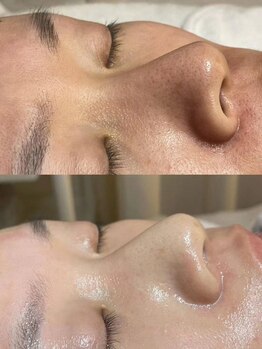 ホワイトビューティ(White beauty)/