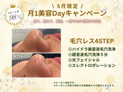 ネオファースト(NeoFirst)の写真