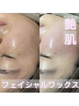 リリーブー 池袋(Lilyboo)/フェイシャルワックス