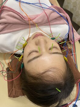 デイジー(DAISY)/美容鍼