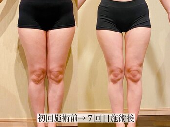 アンジー(Angie)/脚が一回り細く