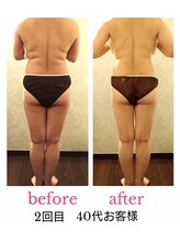 バービーホリック(barbie holic)/１６０分コース 初回/２回目比較