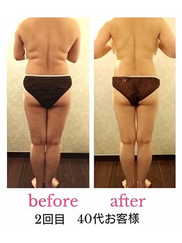 バービーホリック(barbie holic)/１６０分コース 初回/２回目比較