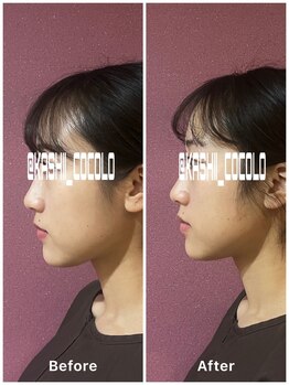 ココロ(CoCoLo)/ビフォーアフター