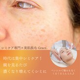 グレイス(Grace)