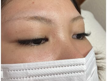 オランダエステティック(Holland Esthetics)/LED 60/60