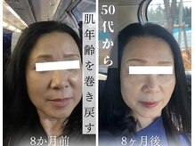 シャイネル(SHYNELL)