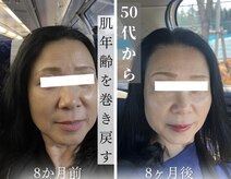 シャイネル(SHYNELL)