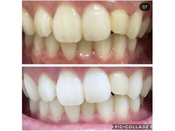 ホワイトアイ 谷町四丁目(WHITE EYE)/ホワイトニング