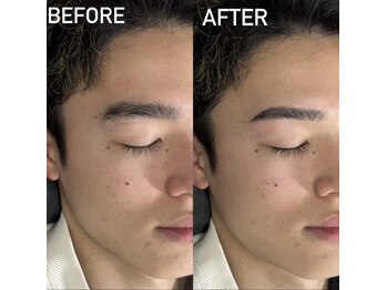 リノプラス 渋谷店(LINOPLUS)/大人気！パラレルブロウ/眉毛