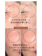 アンフィニ 麻布十番(Infini)/ヒト幹細胞フェイシャル