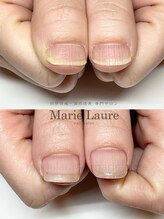 マリーロール 梅田店(Marie Laure)/深爪矯正/自爪育成/ネイルケア