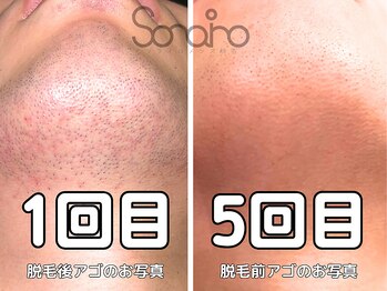 ソライロ