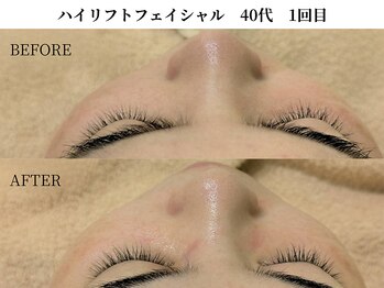 サンビ(SANBI)/大切な日の立体小顔に！