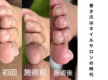 ナンバーアンドスリーサン(No&33)の雰囲気（巻き爪ケアジェルネイルで改善/足の深爪/変色も）