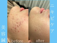 ビープラス(BEE PLUS)