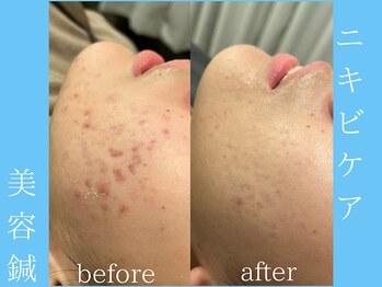 ビープラス(BEE PLUS)