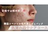 【1回で実感】繰り返すニキビ・毛穴詰まり根本改善★札幌希少韓国肌管理