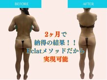 エクラ(Eclat)/Eclatの痩身★BeforeAfter8