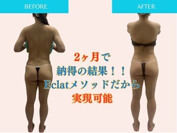 エクラ(Eclat)/Eclatの痩身★BeforeAfter8