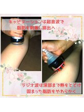 ノア/ラジオ波＋キャビテーション