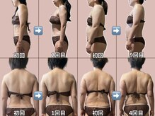 ナーズプラス リベルテ(Naz Plus/Liberte)/筋膜リリース　全身