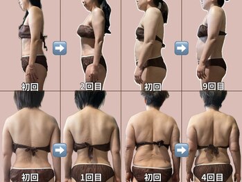 ナーズプラス リベルテ(Naz Plus/Liberte)/筋膜リリース　全身