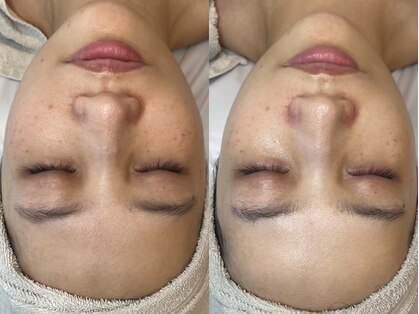 リリウム(Lilium)の写真