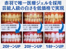 スマイルホワイト 赤羽店