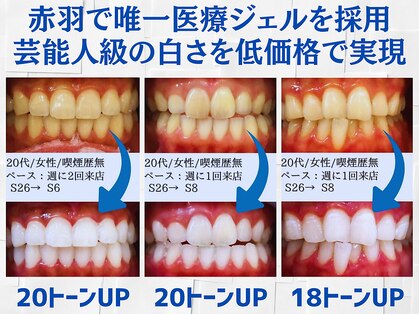 スマイルホワイト 赤羽店の写真