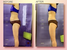 ジュリア オージェ 四条河原町店/ ビフォーアフター（エンダ)