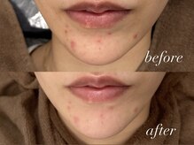 フェイン 青山店(fein.)/クリスティーナ【アンストレス】