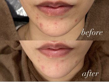 フェイン 青山店(fein.)/クリスティーナ【アンストレス】