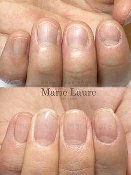 マリーロール 天王寺店(Marie Laure)/深爪矯正/自爪育成/ネイルケア