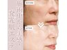 水光肌・中顔面短縮小顔人気NO1/ほうれい線毛穴黒ずみ+エクソソーム30000円⇒